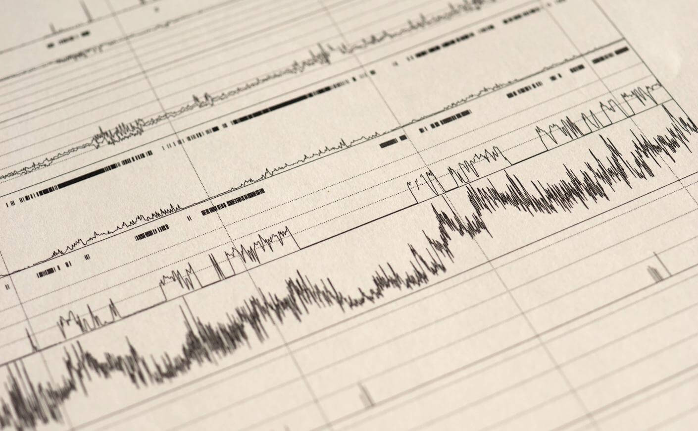 analyse-sommeil-resultats