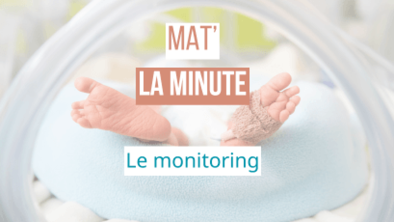 Le monitoring